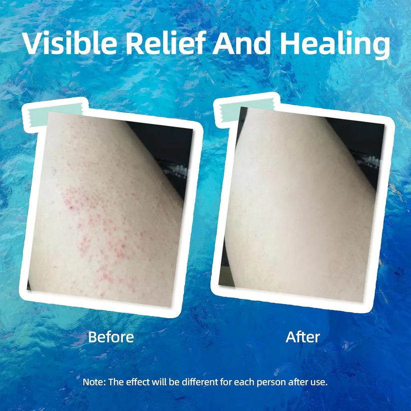 Hydrating Eczema Soothing Cream