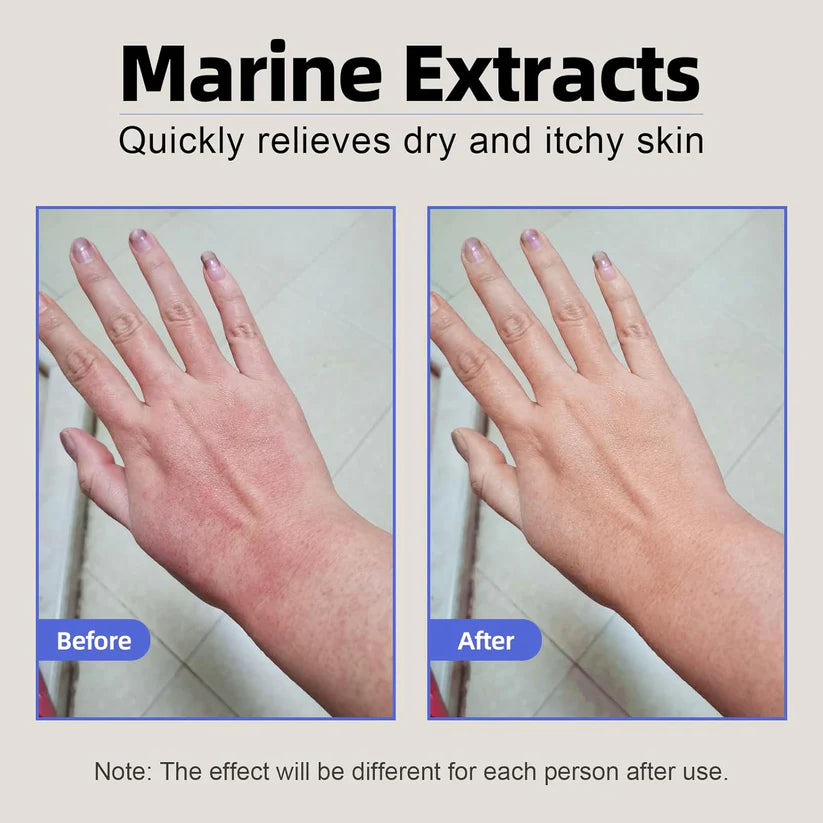 Hydrating Eczema Soothing Cream